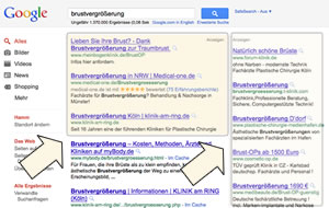 Google AdWords™-Beispiel Brustvergrößerung Google AdWords™-Beispiel Brustvergrößerung